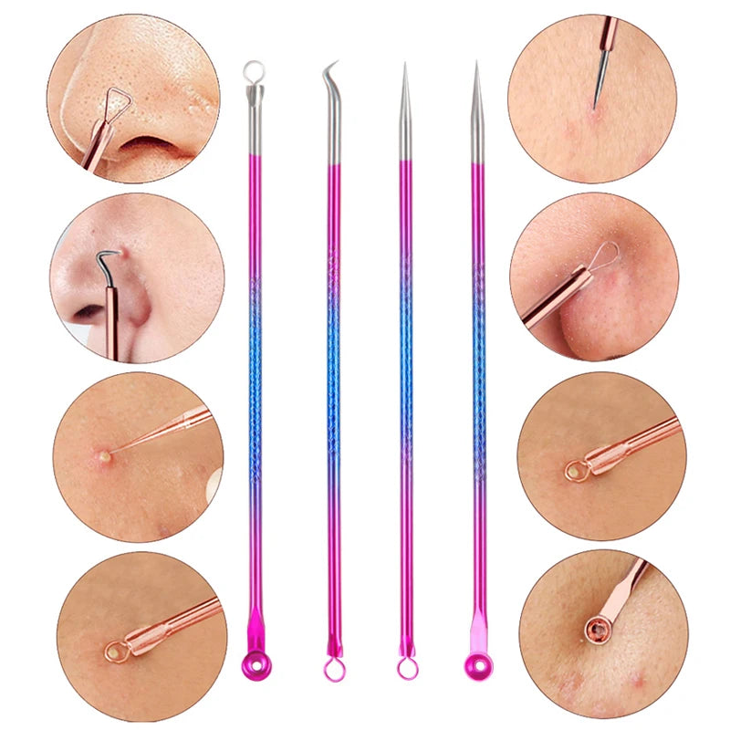Pimple & Blackhead Tool Set - Pore Cleanser