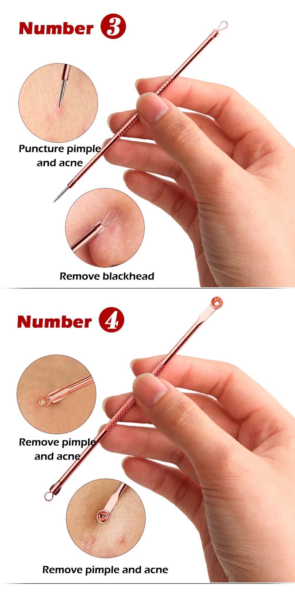 Pimple & Blackhead Tool Set - Pore Cleanser